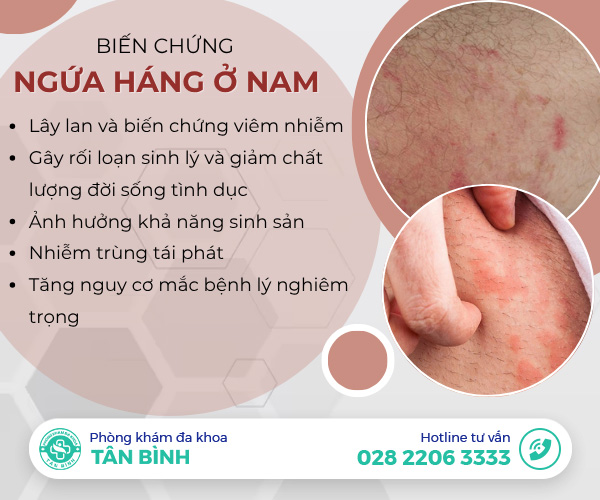 Chuyên gia cảnh báo: Nam giới đừng chủ quan khi ngứa hai bên háng kéo dài