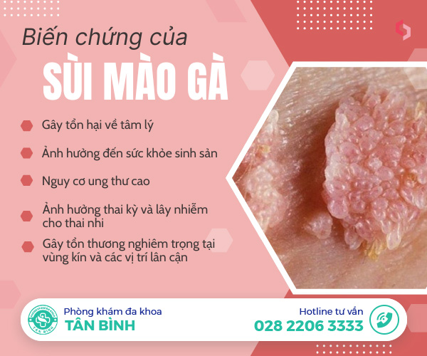 Một số dấu hiệu sùi mào gà mà bạn cần lưu ý