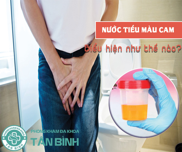 Nước tiểu màu cam có đáng lo ngại? Nguyên nhân và cách điều trị hiệu quả