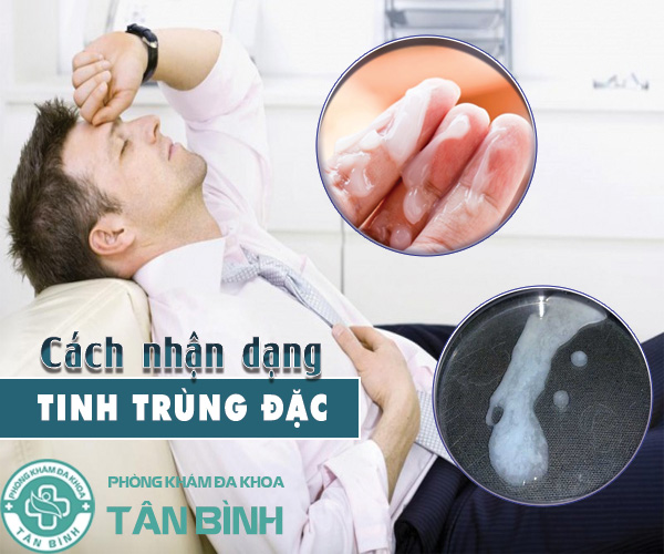 Cách nhận dạng tinh trùng đặc mà cánh mày râu nên lưu ý