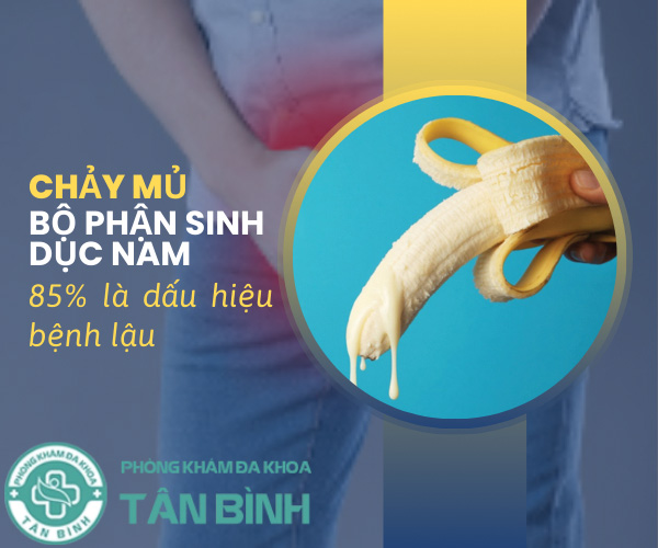Giải mã hiện tượng chảy mủ ở bộ phận sinh dục nam cùng các chuyên gia