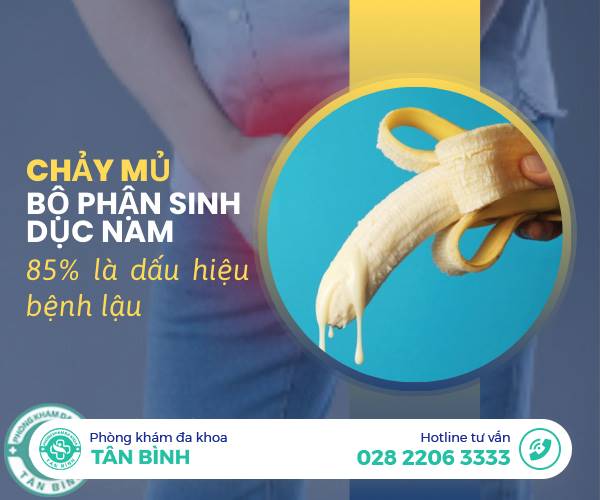 Giải mã hiện tượng chảy mủ ở bộ phận sinh dục nam cùng các chuyên gia