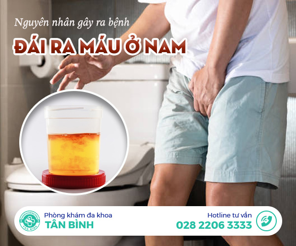 Điểm danh một số nguyên nhân gây ra bệnh đái ra máu phổ biến