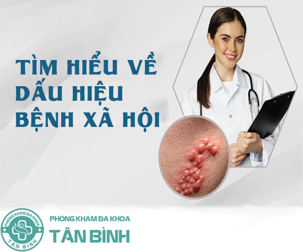 Tổng hợp những dấu hiệu bệnh xã hội dễ nhận biết