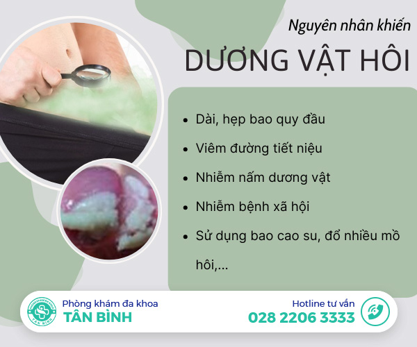 Đừng xem nhẹ tình trạng dương vật hôi - Hậu quả nghiêm trọng hơn bạn nghĩ