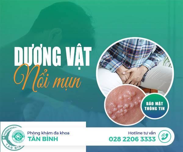 Dương vật bị nổi mụn là bệnh gì? Phác đồ điều trị mụn dương vật hiệu quả