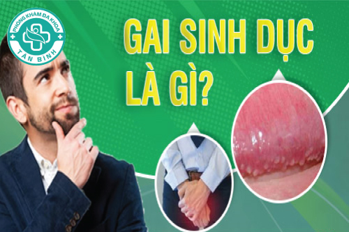 Gai sinh dục là gì? Chữa gai sinh dục bằng cách nào?