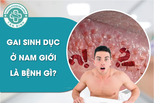 Gai sinh dục ở nam giới là bệnh gì?