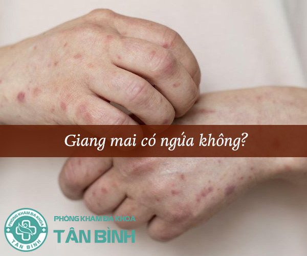 Giải đáp thắc mắc: Giang mai có ngứa không?