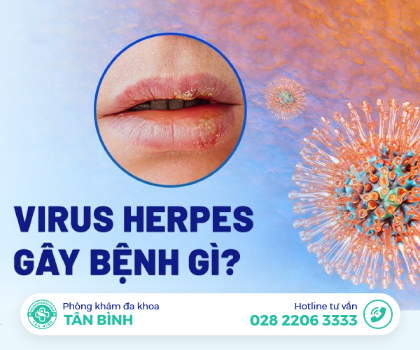 Giải mã HSV là bệnh gì? Cảnh báo từ chuyên gia khiến bạn phải kiểm tra ngay!