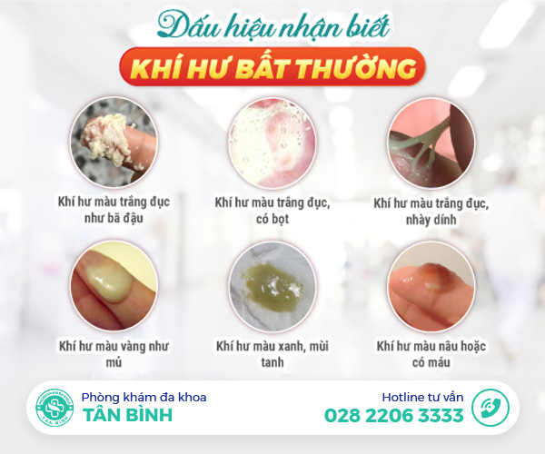 [CẢNH BÁO] Âm đạo chảy dịch bất thường - Đừng chủ quan với dấu hiệu này!