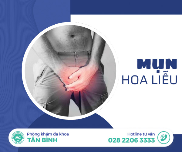 Đừng chủ quan với mụn hoa liễu – Biểu hiện của bệnh xã hội nguy hiểm