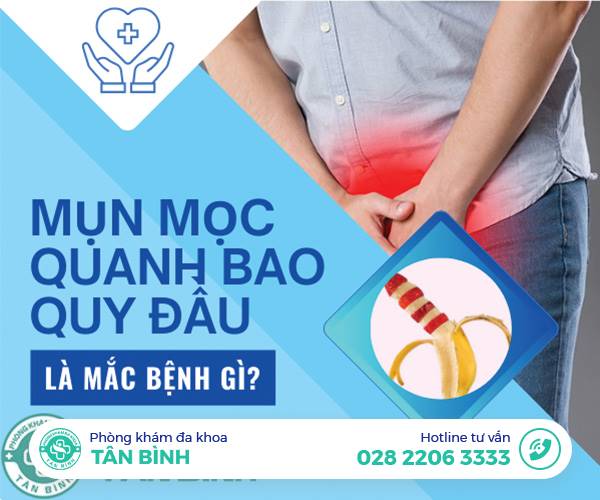 Tình trạng mụn mọc quanh bao quy đầu là bệnh gì? Có cách chữa không?