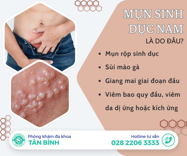 Mụn sinh dục nam - Đừng xem nhẹ nếu bạn chưa từng xét nghiệm bệnh xã hội