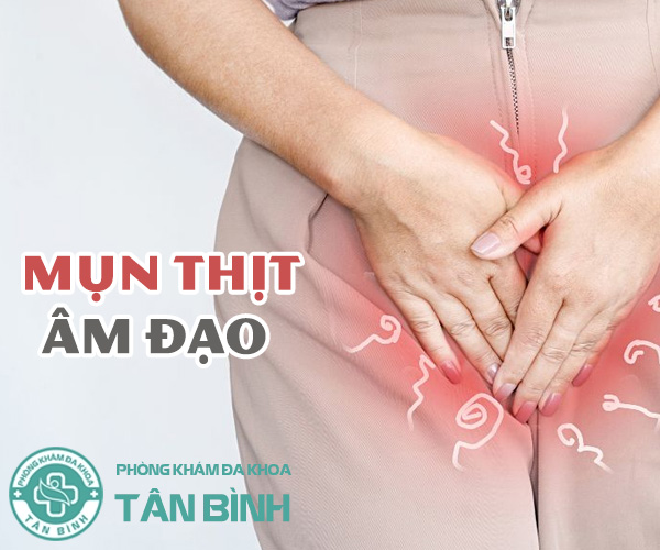 Bị nổi mụn thịt âm đạo là do đâu? Chữa như thế nào?