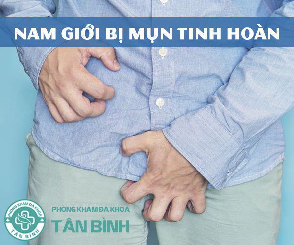 Nguyên nhân gây mụn tinh hoàn và cách chữa hiệu quả