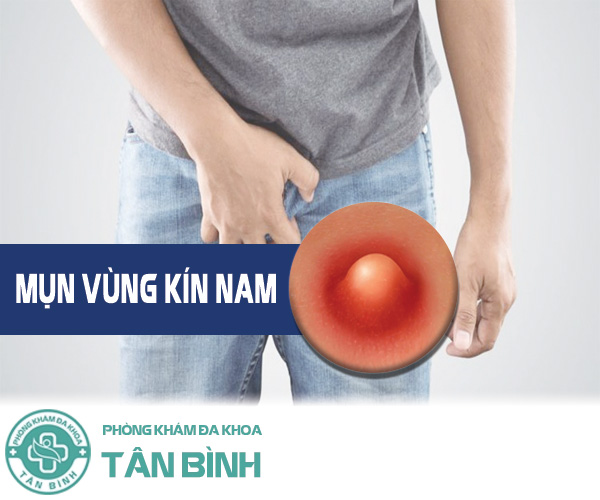 Vì sao nam giới bị nổi mụn vùng kín? Cách trị mụn vùng kín nam hiệu quả