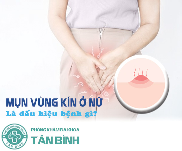 Nổi mụn vùng kín ở nữ là biểu hiện của bệnh gì? Cách điều trị dễ hay khó?