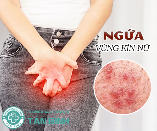 Nguyên nhân và cách chữa ngứa vùng kín ở nữ giới