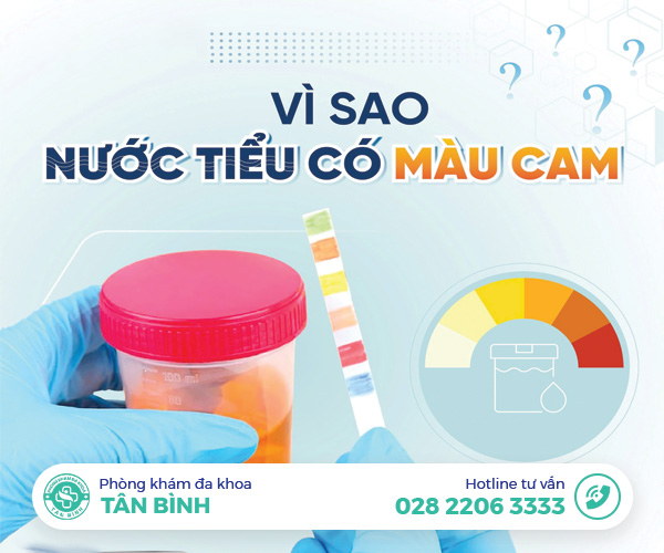 Nước tiểu màu cam – Nam giới mắc phải những bệnh lý này mà không biết