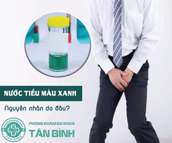 Nước tiểu màu xanh - Dấu hiệu cảnh báo điều bất thường