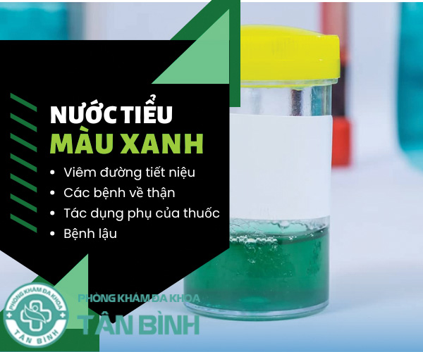 Nước tiểu màu xanh - Dấu hiệu cảnh báo điều bất thường