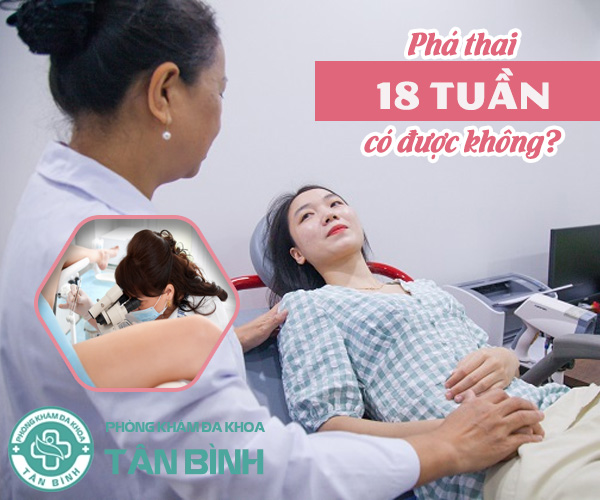 Chị em lo lắng phá thai 18 tuần có được không?