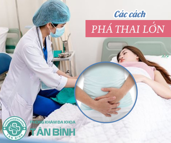 Bật mí các cách phá thai lớn an toàn