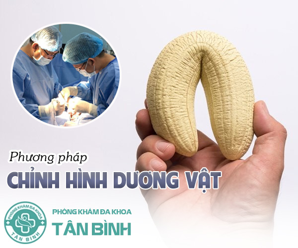 Chỉnh hình dương vật phương pháp tiên tiến hiện nay