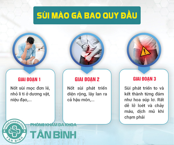 Cẩn trọng trước căn bệnh sùi mào gà bao quy đầu