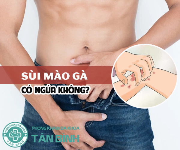 Người bệnh thắc mắc sùi mào gà ngứa không?