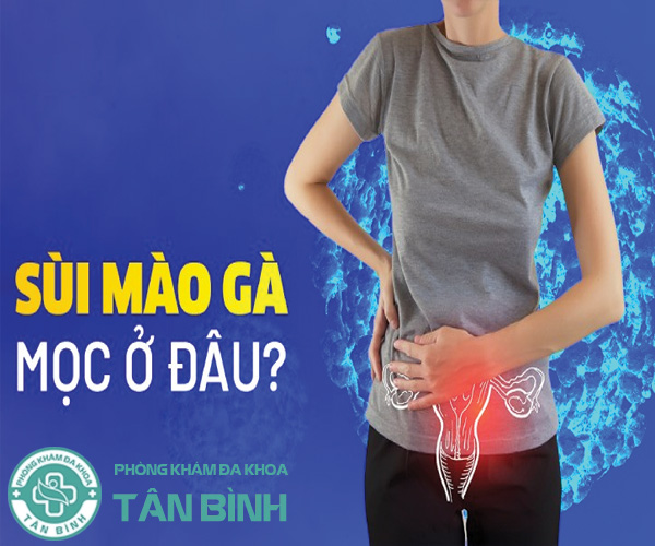 Sùi mào gà mọc ở đâu? Những vị trí thường gặp và dấu hiệu nhận biết