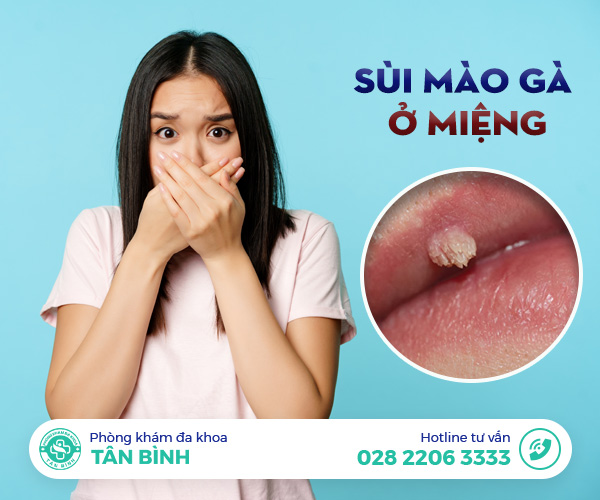 Sùi mào gà ở miệng nguy hiểm như thế nào? Chữa ở đâu mới khỏi?