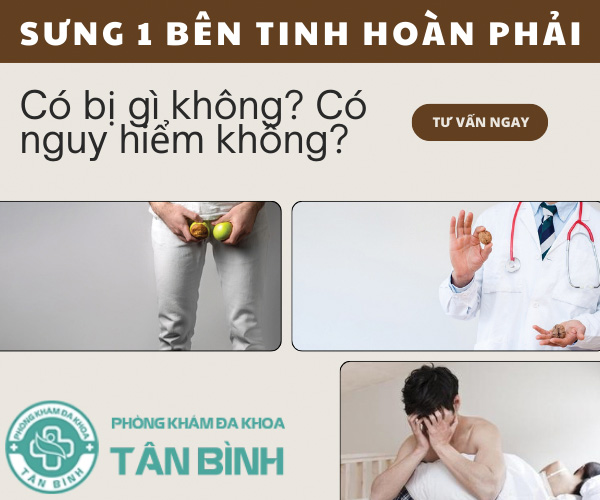 Sưng 1 bên tinh hoàn phải có sao không?