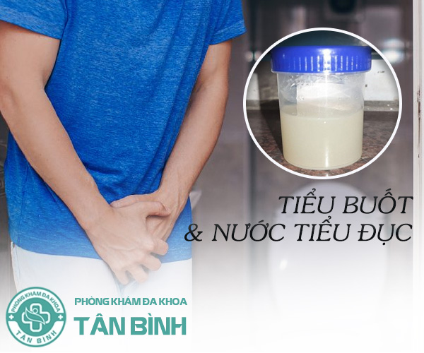 Tiểu buốt nước tiểu đục cảnh báo bệnh lý nguy hiểm gì?