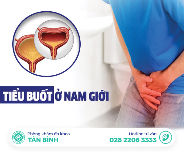 Chứng tiểu buốt ở nam giới cảnh báo điều gì? Có cách điều trị không?