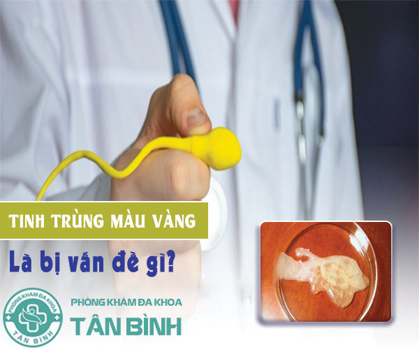 Nguyên nhân tinh trùng màu vàng và phương pháp điều trị hiệu quả nhanh