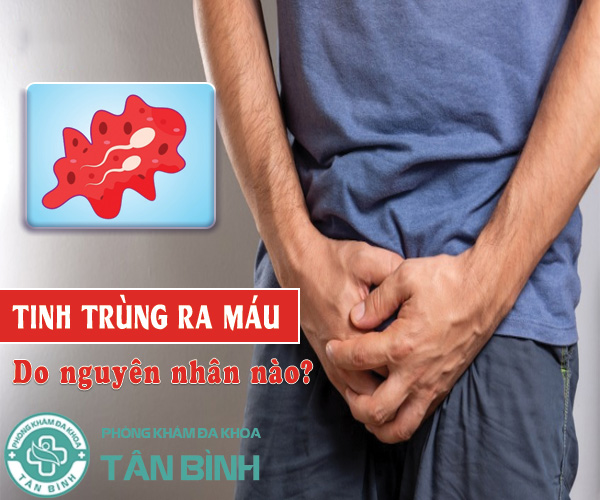 Tìm hiểu cụ thể về hiện tượng tinh trùng ra máu