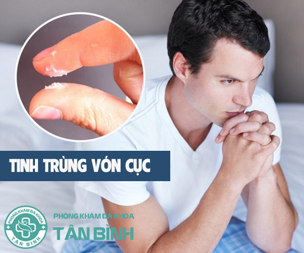 Nguyên nhân tinh trùng vón cục là do đâu? Điều trị ra sao?