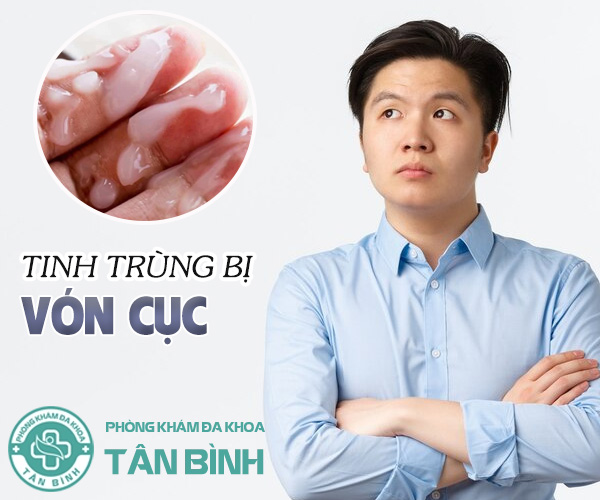 Hiện tượng xuất tinh bị vón cục là do đâu? Có nguy hiểm không?