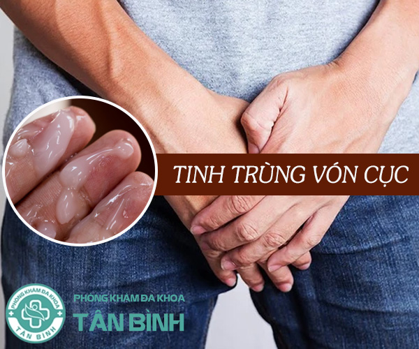 Tại sao tinh trùng vón cục? Điều trị như thế nào mới hiệu quả?