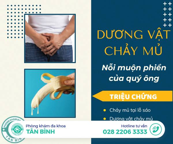 Những điều cần biết về tình trạng dương vật chảy mủ trắng