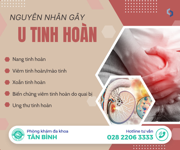 Tất tần tật về u tinh hoàn - Dấu hiệu cảnh báo nam giới không nên bỏ qua