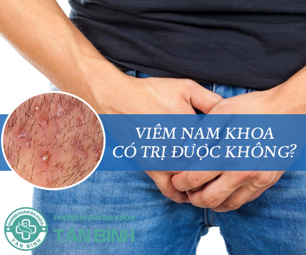 Nam giới thắc mắc viêm nam khoa có trị được không?