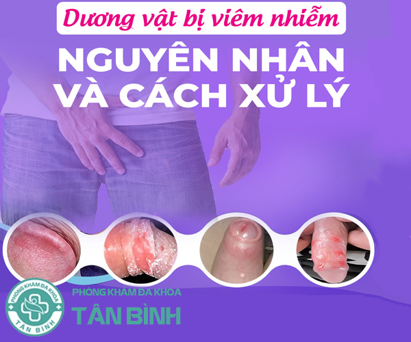 Nguyên nhân gây viêm nhiễm dương vật cần lưu ý