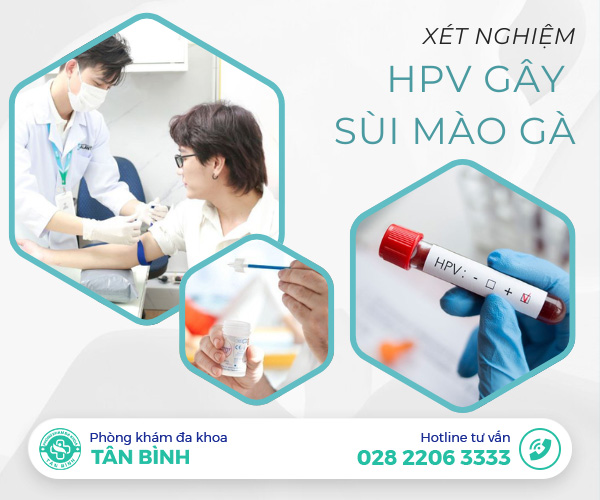 Xét nghiệm HPV gây sùi mào gà ở đâu uy tín?