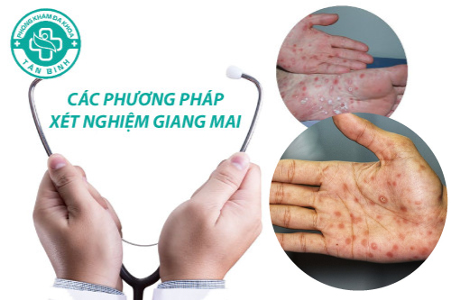 Tìm hiểu các phương pháp xét nghiệm giang mai hiện nay