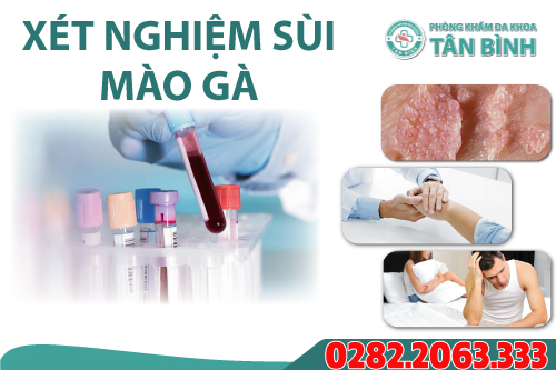 Xét nghiệm bệnh sùi mào gà bằng phương pháp nào?