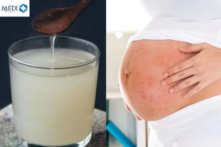 Bà Bầu Có Được Ăn Sắn Dây Luộc Không? Lưu Ý Và Lợi Ích Khi Dùng Bà Bầu Có Được Ăn Sắn Dây Luộc Không? Lưu Ý Và Lợi Ích Khi Dùng