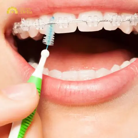 Top 7 Bàn Chải Kẽ Răng Tốt Nhất Hiện Nay: Lựa Chọn Hoàn Hảo Cho Răng Sạch Sâu